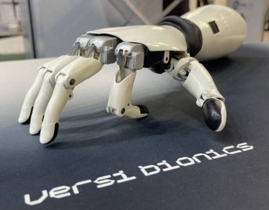 Versi Bionics - біонічна рука з відчуттям дотику. Джерело: Versi Bionics